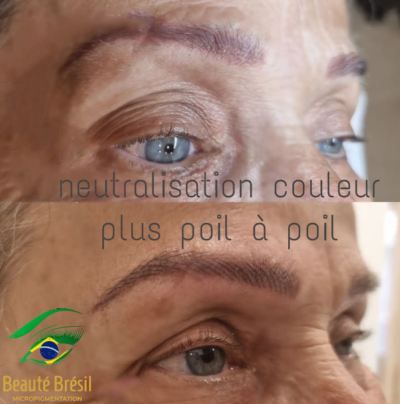 Avant et après : neutralisation de couleur et poil à poil, Beauté Brésil